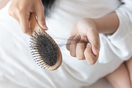 Perimenopause Hair Loss and What You Can Do About It