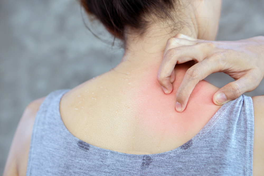 Perimenopause Symptom: Itchy Skin and How To Make It Better
